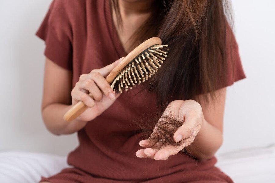 Rụng tóc nhiều hơn 100 sợi/ ngày là dấu hiệu không tốt