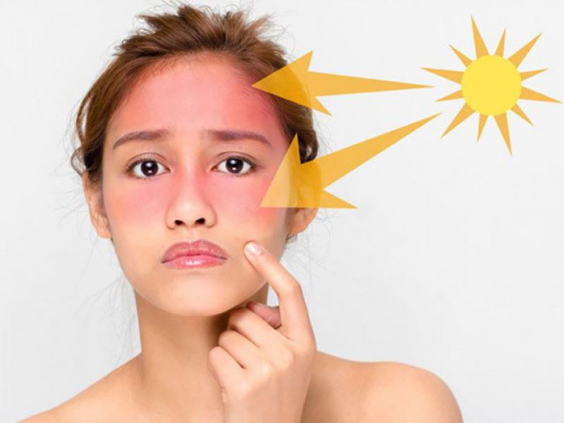 Ánh nắng mặt trời có chứa tia UV gây hại cho da