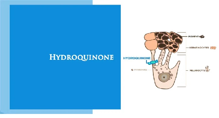 Hydroquinone ức chế sản sinh melanin