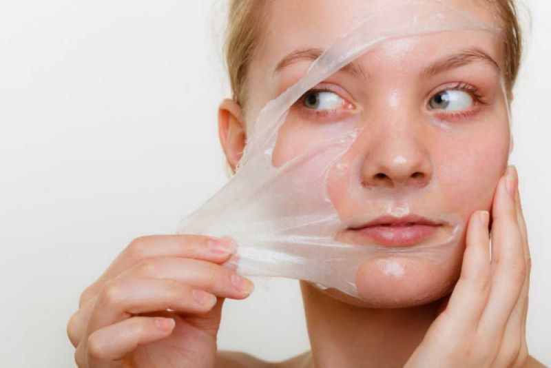 Phương pháp peel da giúp cải thiện tình trạng mụn viêm