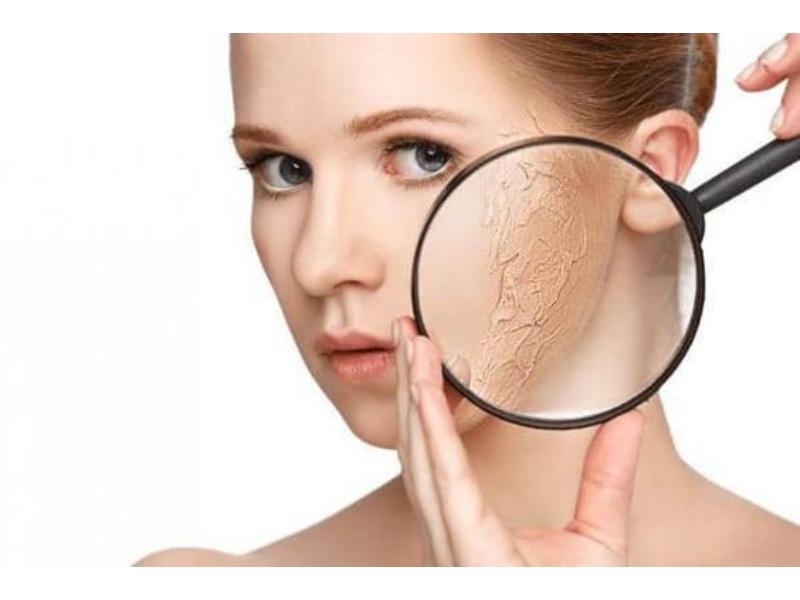 Để khắc phục làn da khô nên dưỡng ẩm thường xuyên cho da