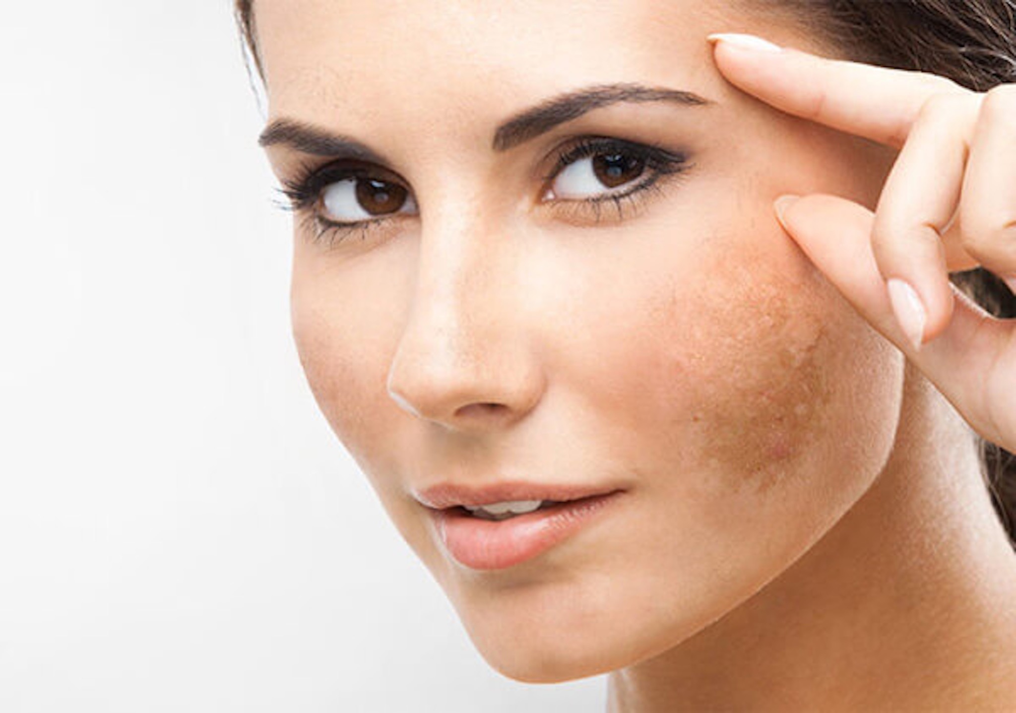 Với công dụng làm sáng da, giảm thâm có thể cải thiện tình trạng nám, tàn nhang và thâm mụn.