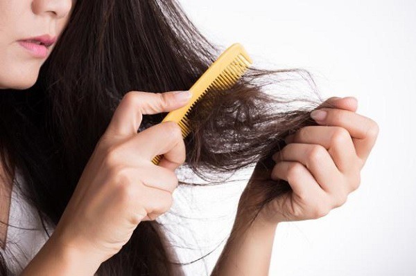Chải tóc khi nó còn ướt có thể gây ra rụng tóc